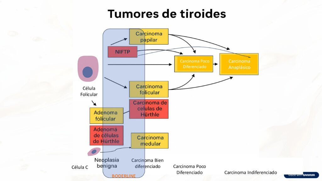 Progresión del Cancer de iroides de lesiones precursoras a Cancer de Alto Grado
