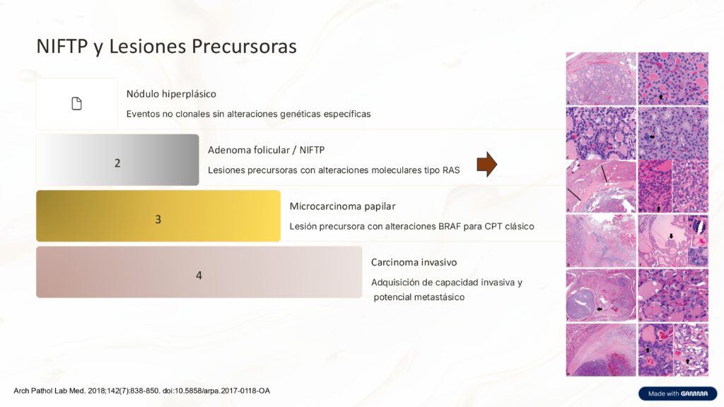 NIFTP Y LESIONES PRECURSORAS