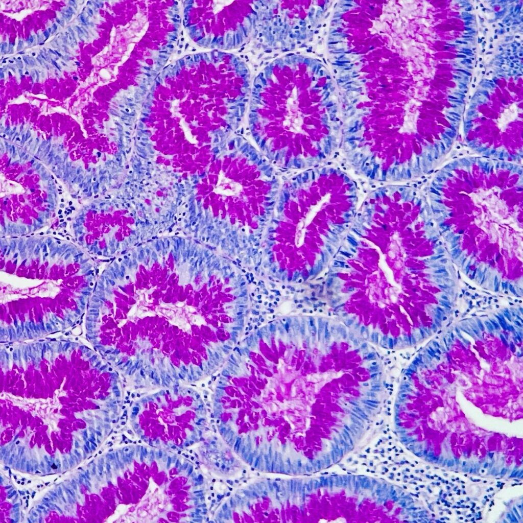 mUCOSA cOLONICA CON pas