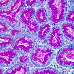 mUCOSA cOLONICA CON pas